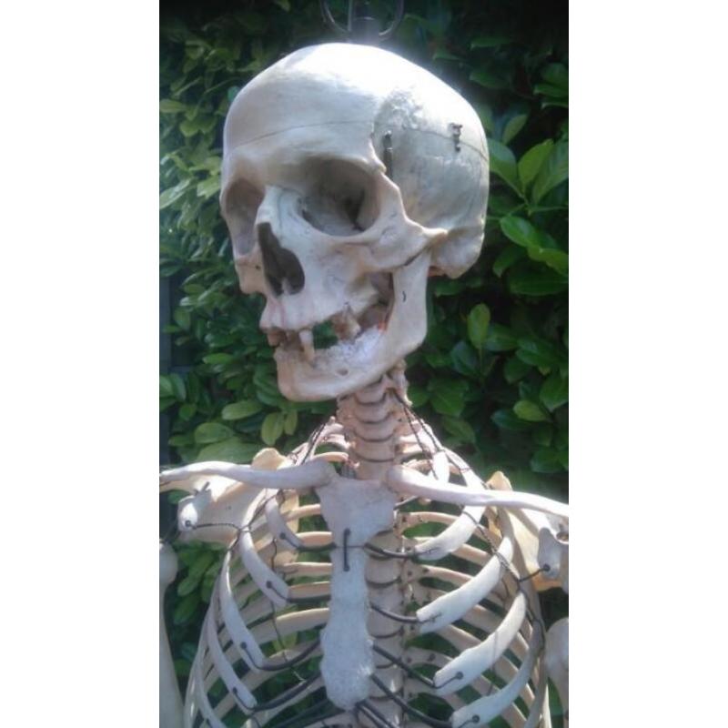 schedel mens skelet